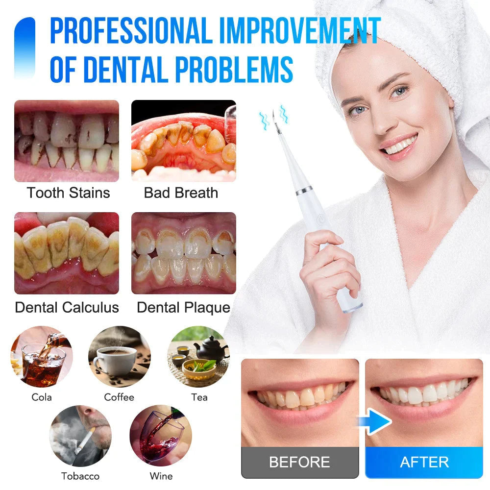 Woman in a white robe holding the white scaler tool, surrounded by close-ups of stained teeth, drinks that cause staining, and a before-and-after smile. 2