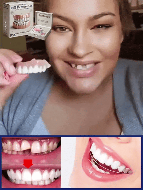 Flexible Denture Set for Upper & Lower Jaw – Reusable & Custom-Fit 5