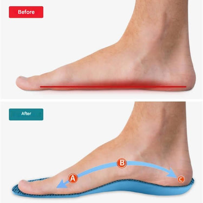 Orthopaedic Insoles – StepRelief