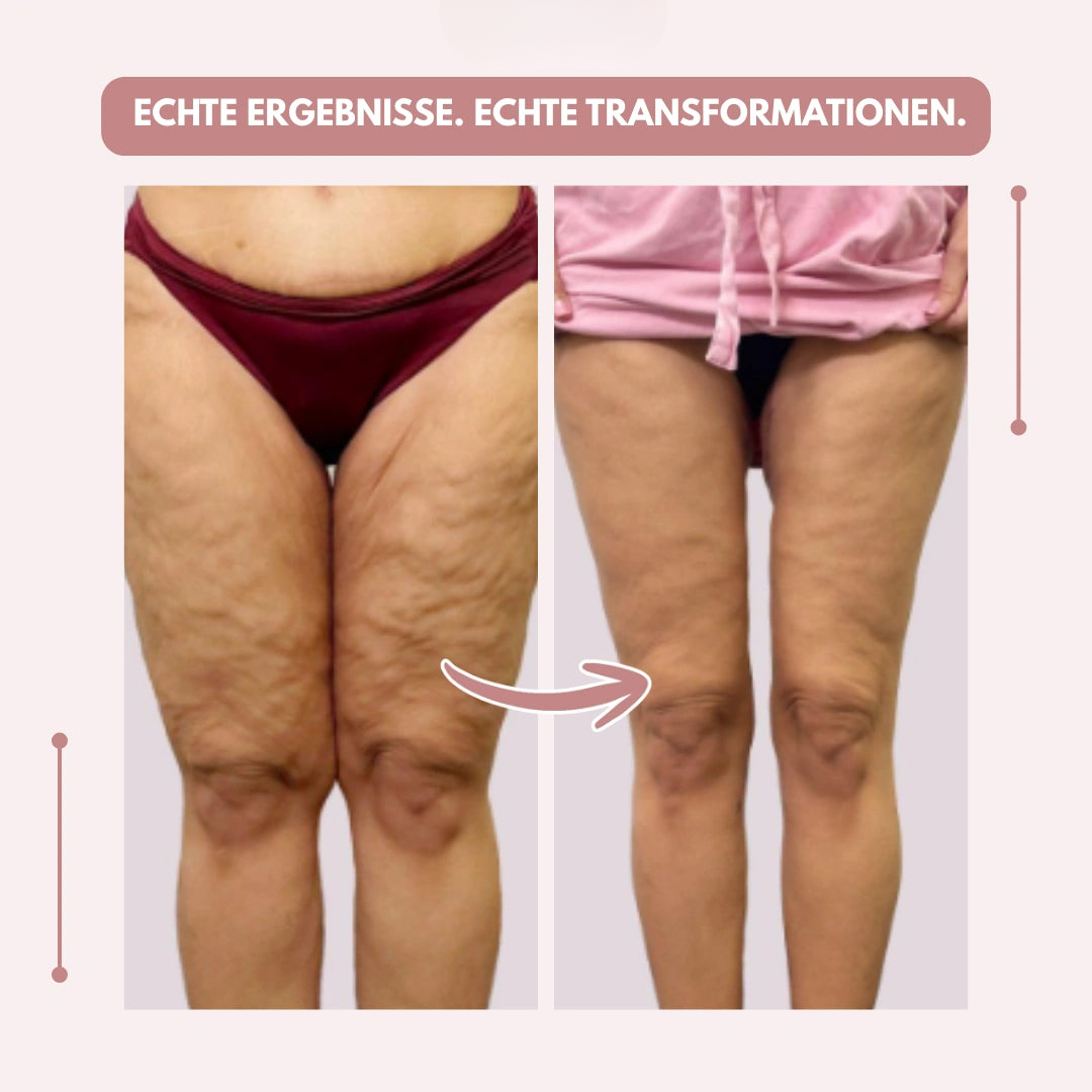 Before-and-after comparison of a woman's thighs from the front, first in burgundy underwear, then in a pink top. 12