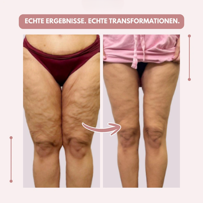 Before-and-after comparison of a woman's thighs from the front, first in burgundy underwear, then in a pink top. 12
