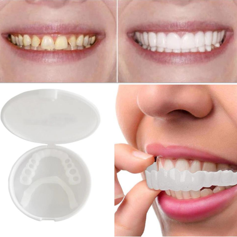 Four-part collage: yellowed teeth beside whitened teeth, an open round case with the veneers, and a hand fitting a veneer. 4