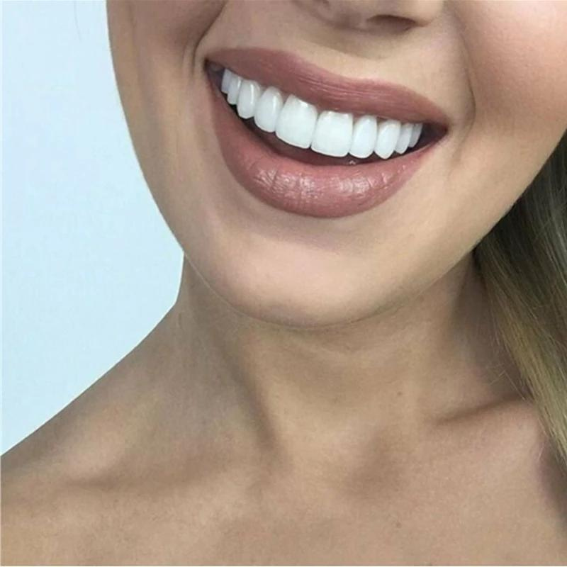 Close-up of a woman with nude lipstick smiling to show a bright, even set of white teeth. 3
