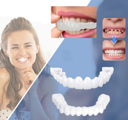 Snap-On Veneers | Flexible No-Glue Fit for Meals and Daily Wear 1