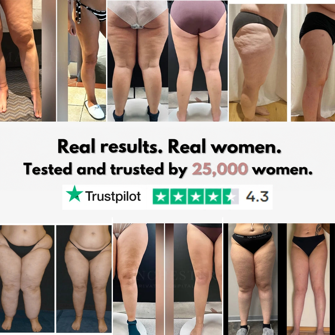 Collage of before-and-after leg photos from several customers, with a customer rating badge below the heading. 13