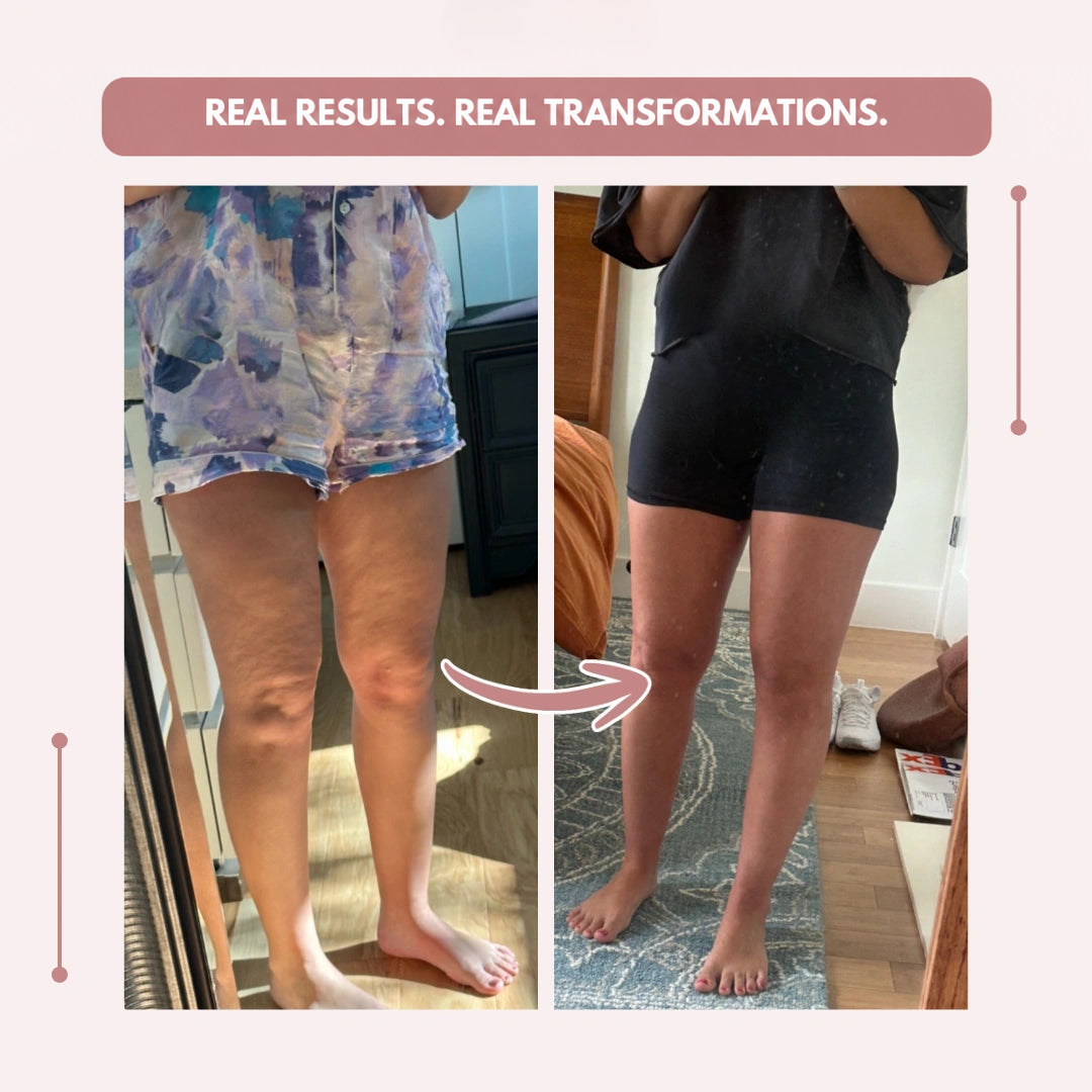 Before-and-after mirror selfies of a customer's legs, first in patterned shorts, then in black shorts and a dark top. 19