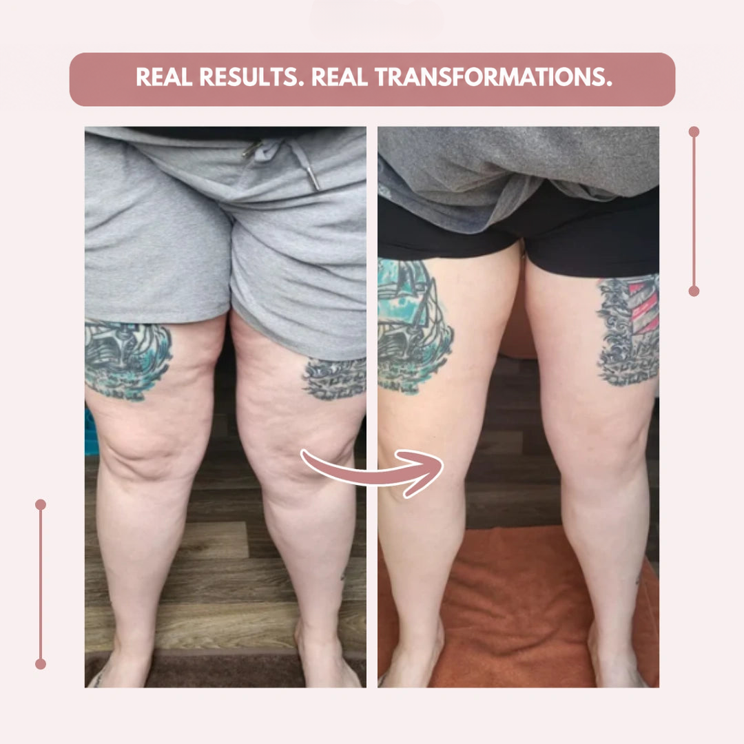 Before-and-after comparison of a customer's legs showing thigh tattoos, first in grey shorts, then in black shorts. 18