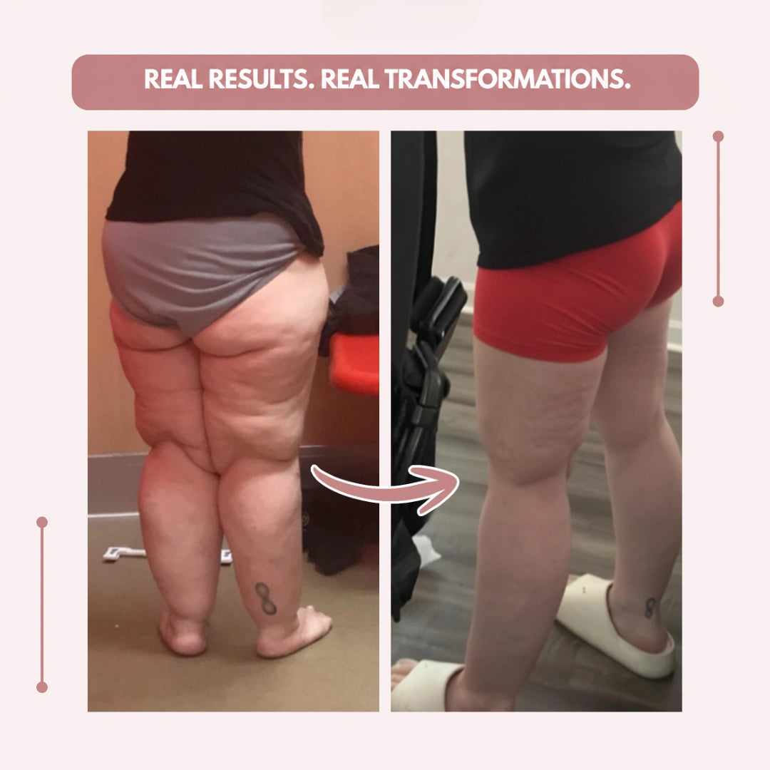 Before-and-after comparison of a woman's legs from behind, shown first in grey underwear, then in red shorts. 10