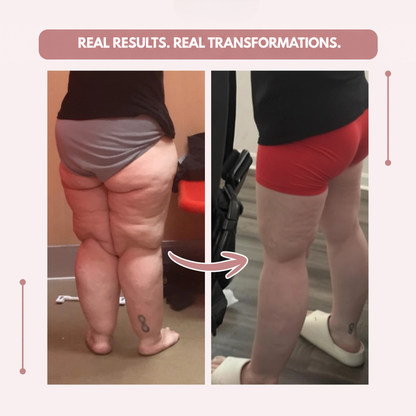 Before-and-after comparison of a woman's legs from behind, shown first in grey underwear, then in red shorts. 10