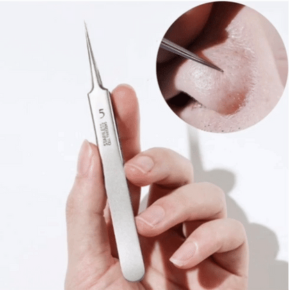 Precision Tweezers for Blackheads & Pimples – Léna