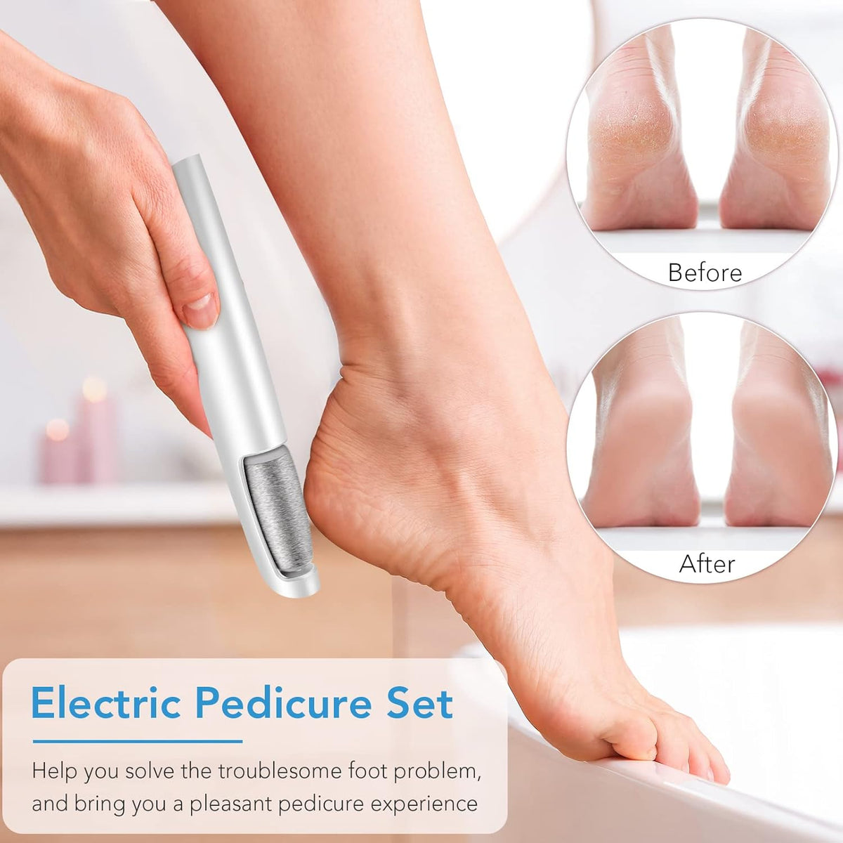 Woman's hand using the white device on a raised heel, with small before and after circles showing cracked and smoothed skin. 2