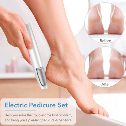 Woman's hand using the white device on a raised heel, with small before and after circles showing cracked and smoothed skin. 2