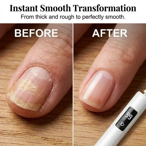 Before-and-after comparison of a rough, ridged nail and a smooth, polished nail on a wooden surface 4